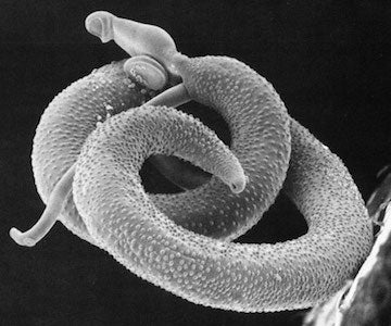 Scanning electron micrograph of a pair of Schistosoma mansoni. This work has been released into the public domain by its author, Uniformed Services University of the Health Sciences. This applies worldwide. 